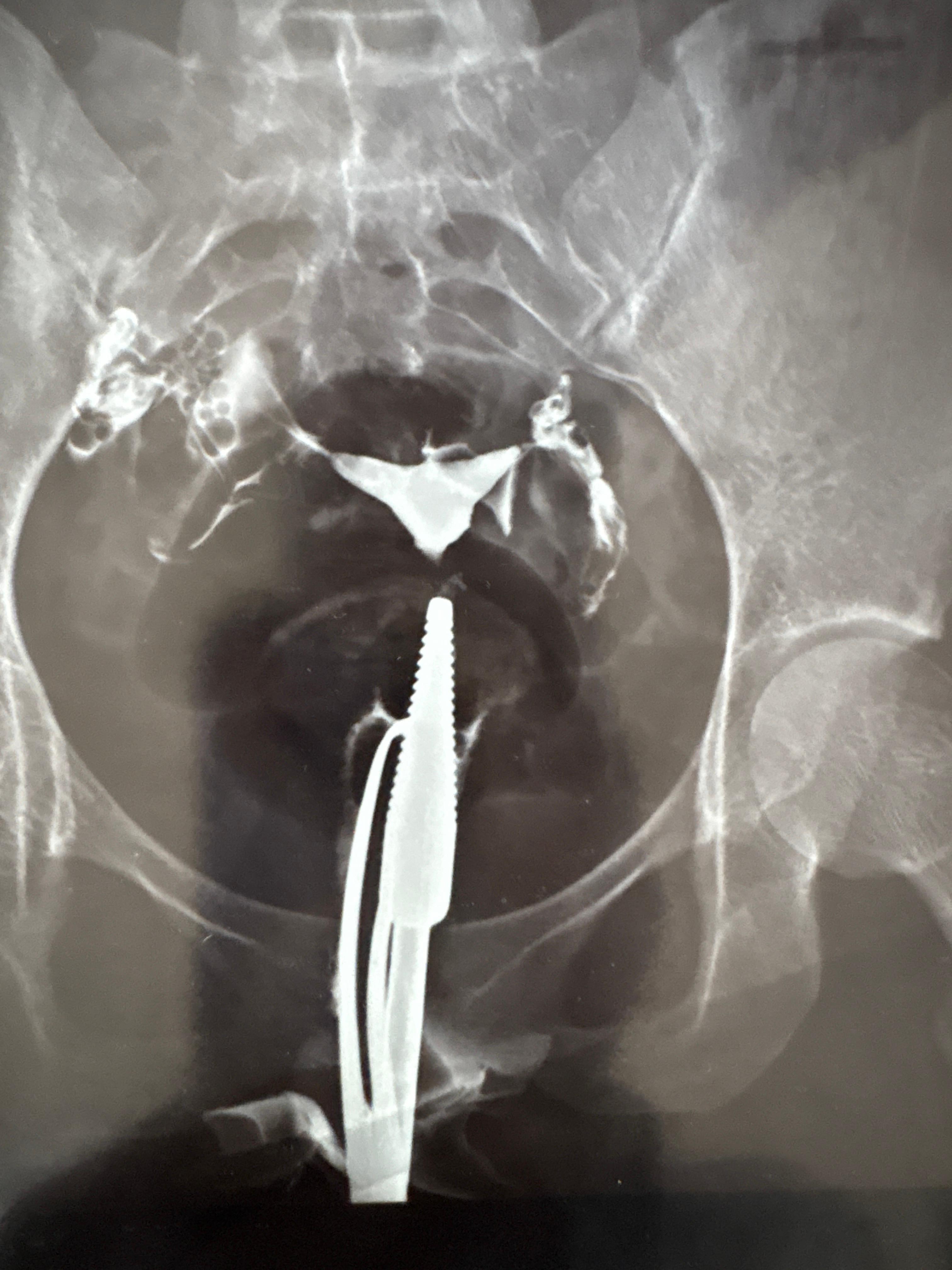 Patient consultation experience photo of Dr Bavin Balakrishnan MBBS MD DNB - Photo 2 at kozhikode 673005