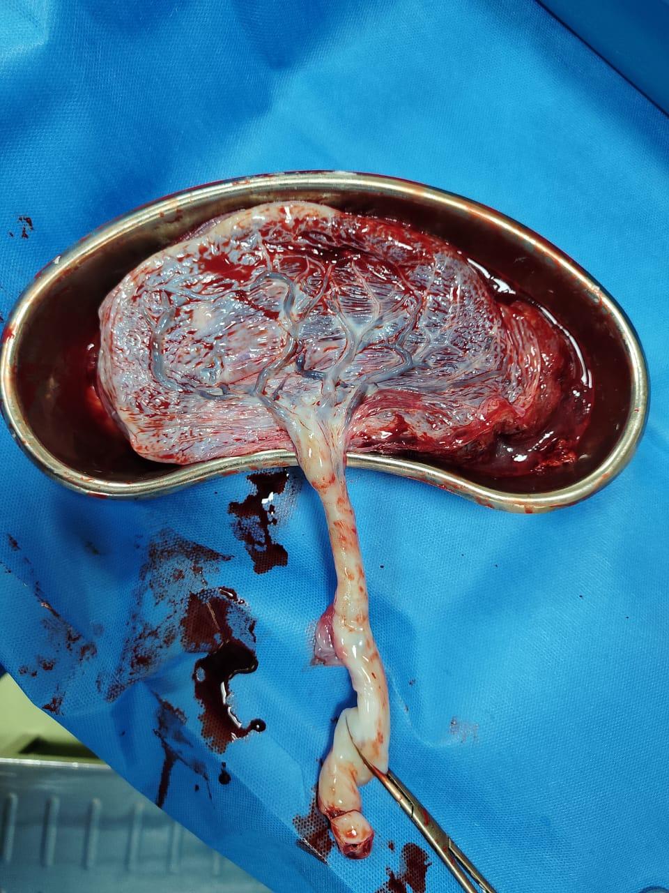 Patient consultation experience photo of Dr Bavin Balakrishnan MBBS MD DNB - Photo 3 at kozhikode 673005