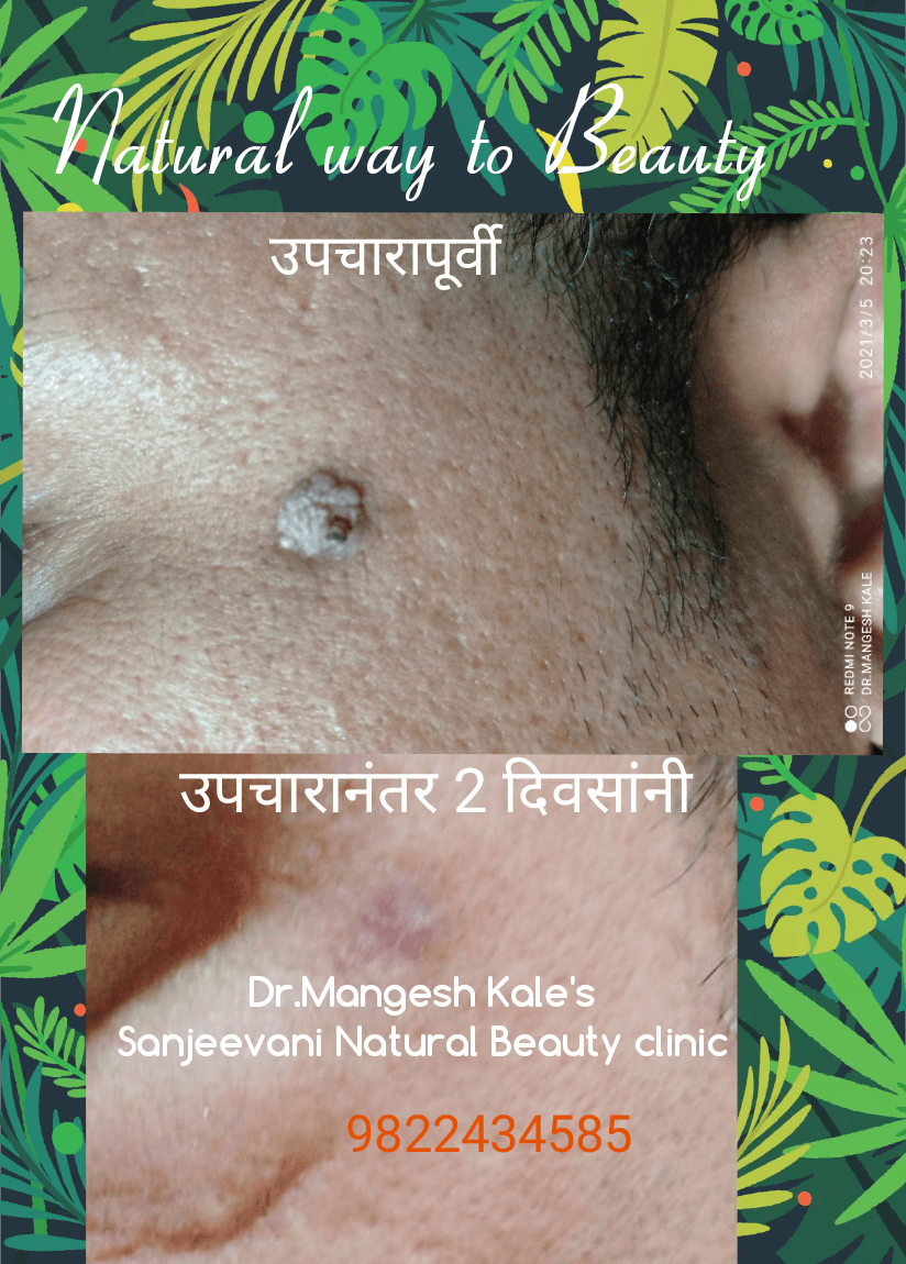Patient consultation experience photo of Sanjeevani Clinic - Photo 2 at Ahmadnagar 414003