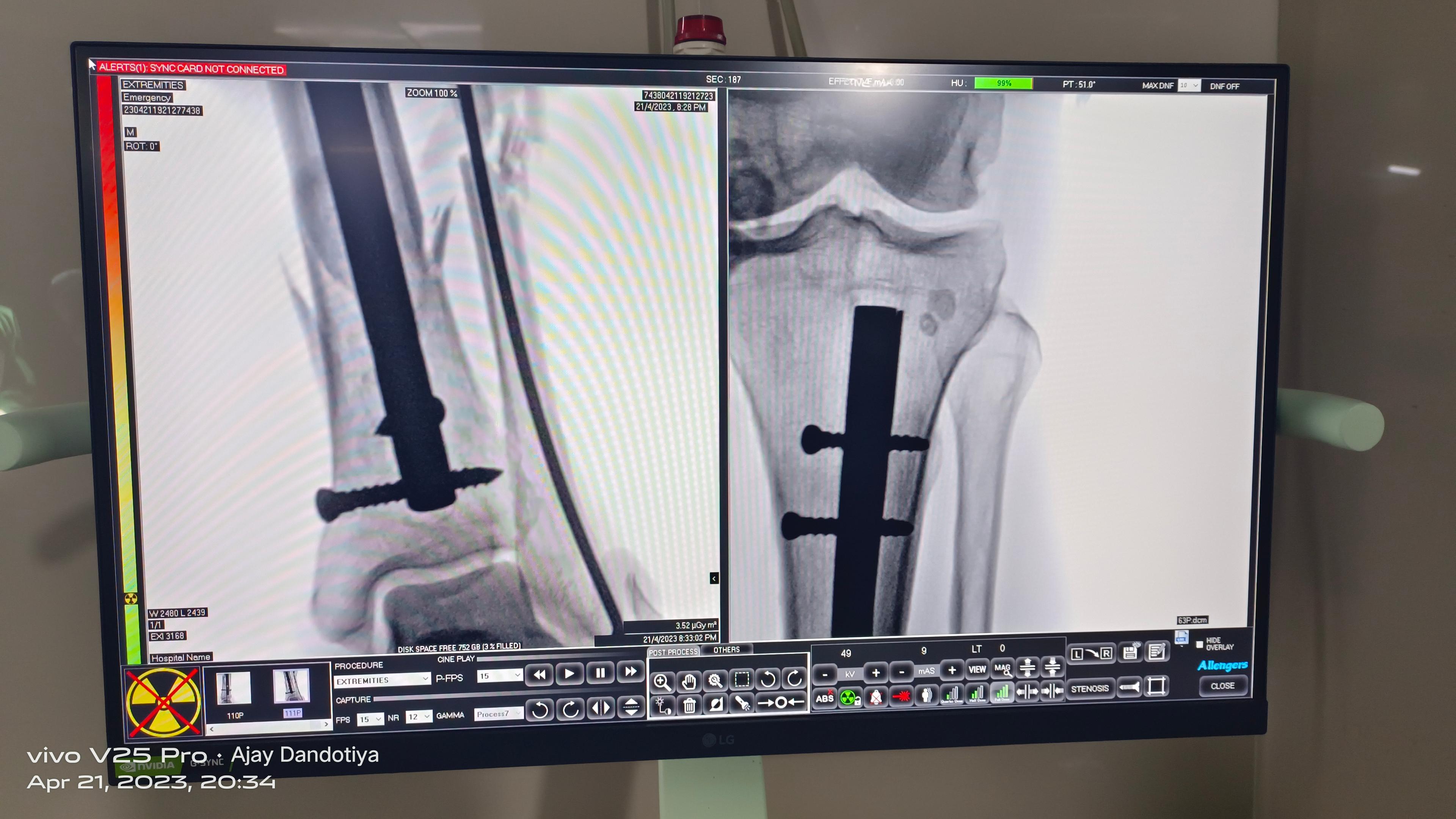 Interior view photo of City Orthopaedic centre - Photo 2 at ujjain 456010