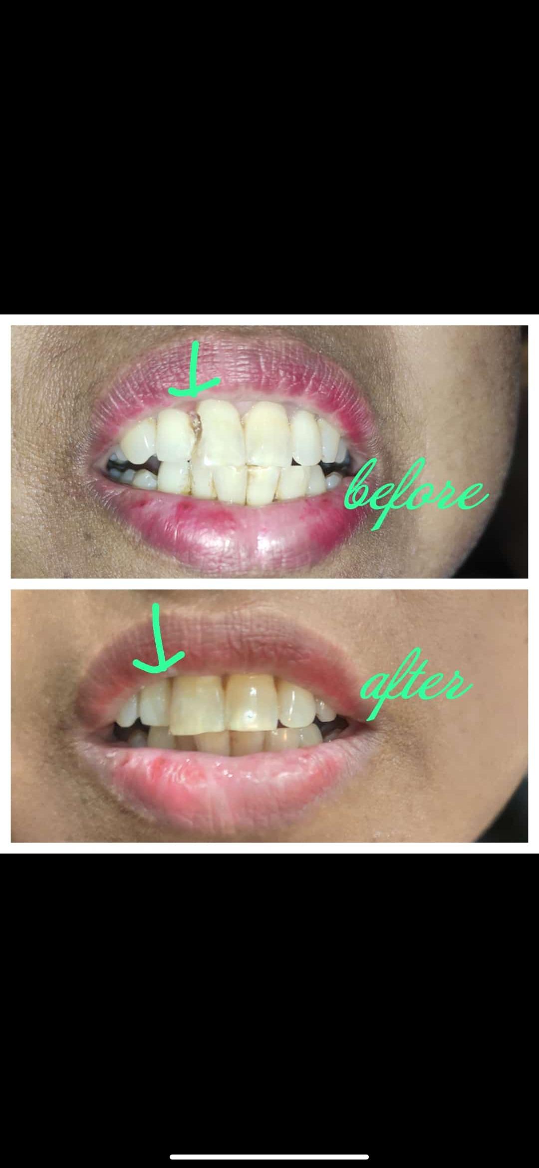 Patient consultation experience photo of J&T Dental Care - Photo 3 at varanasi 221001