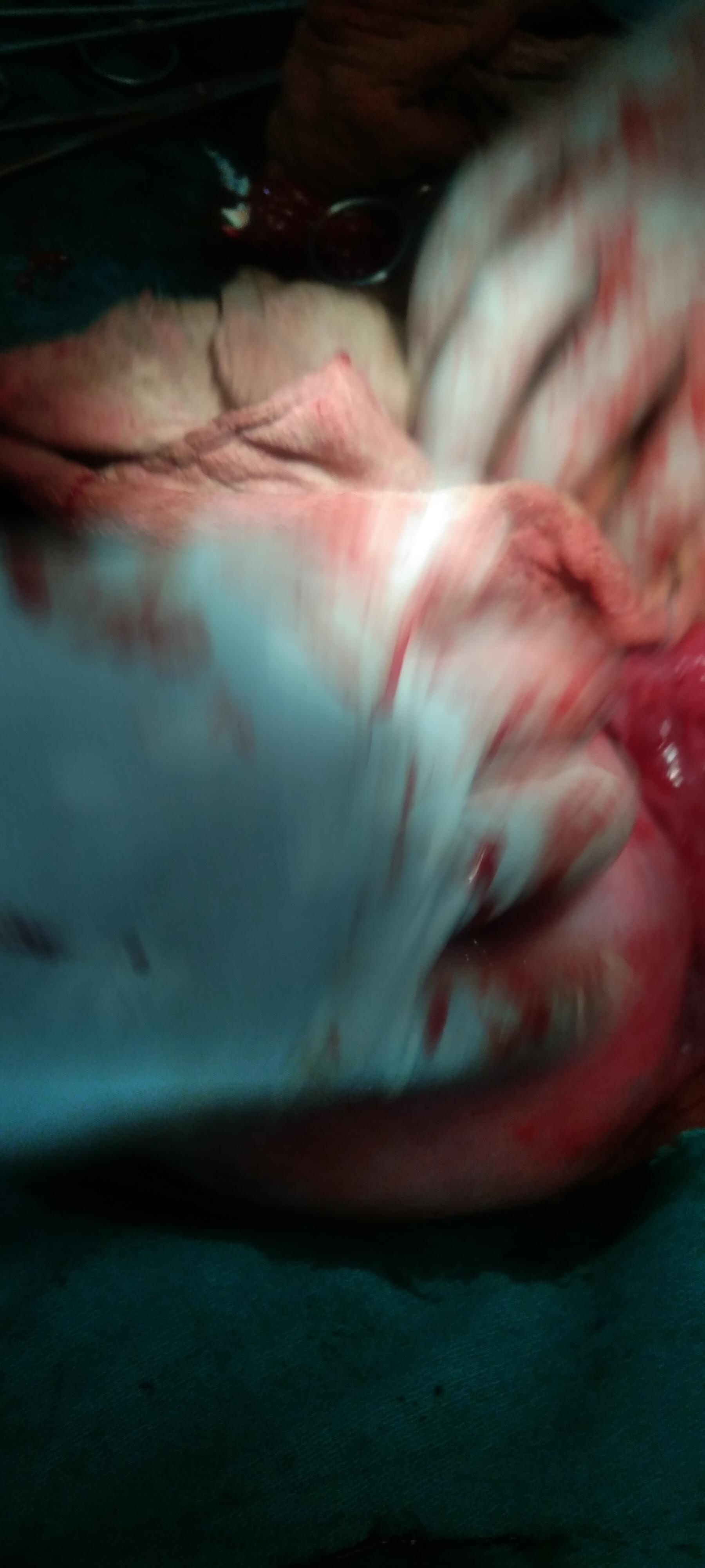 Patient consultation experience photo of UTKARSH HOSPITAL & MATTERNITY CENTER - Photo 2 at Salempur 274509