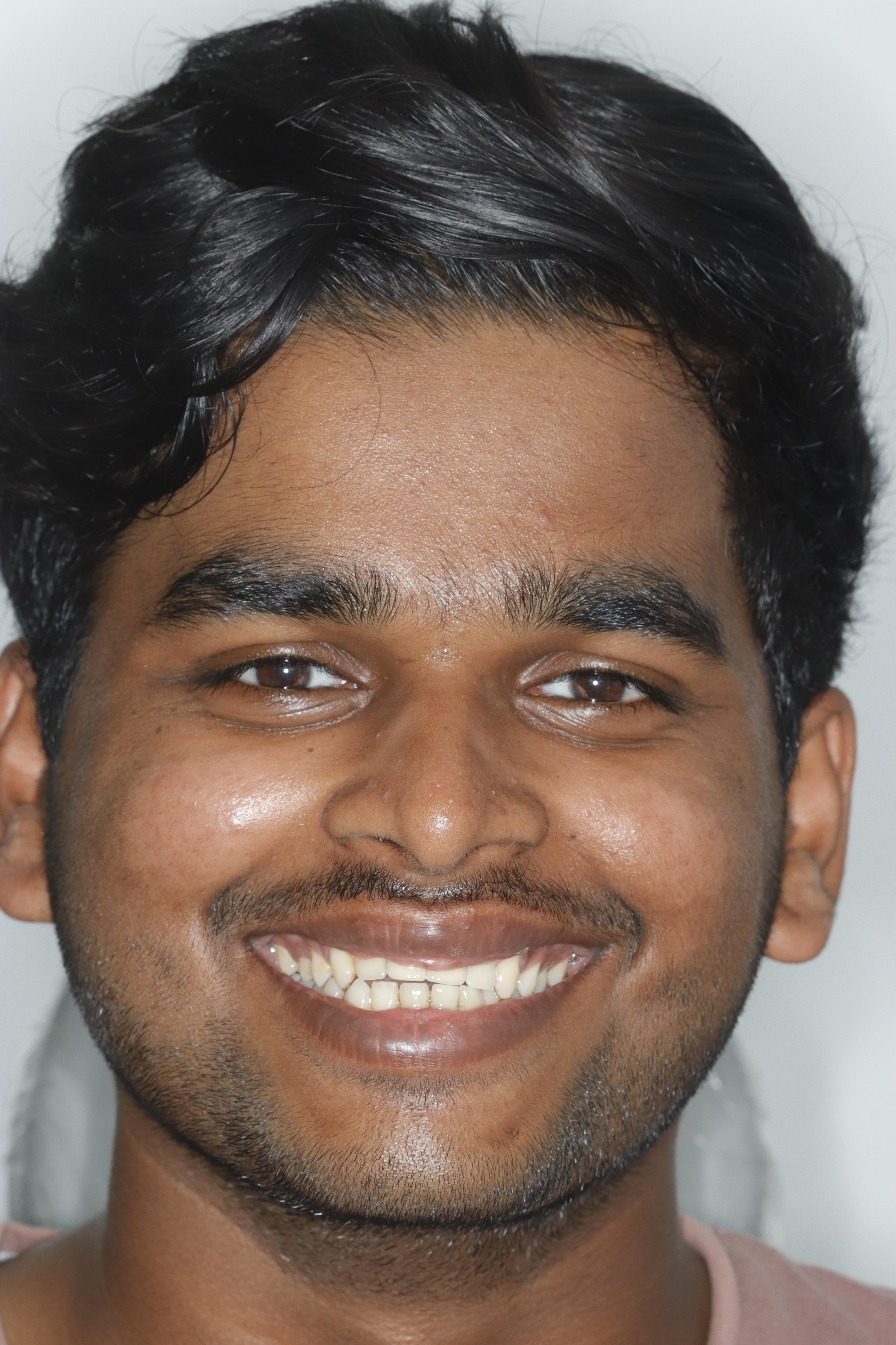 Patient consultation experience photo of i-Smile Dental Implant & Cosmetic Centre - Photo 1 at nagpur 440015