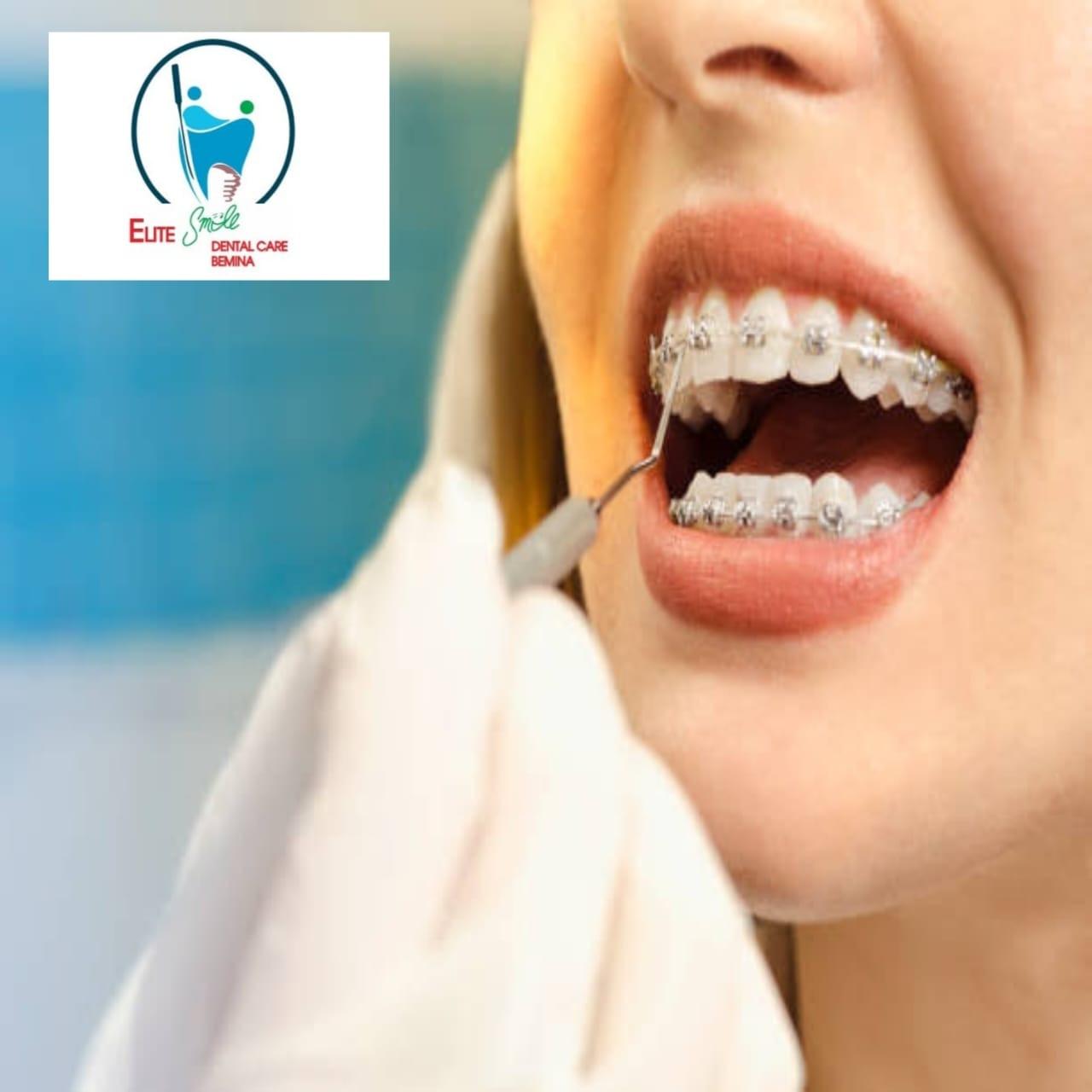 Clinic signage photo of ELITE SMILE DENTAL CARE GOUSIA COLONY BEMINA - Photo 1 at srinagar 190011