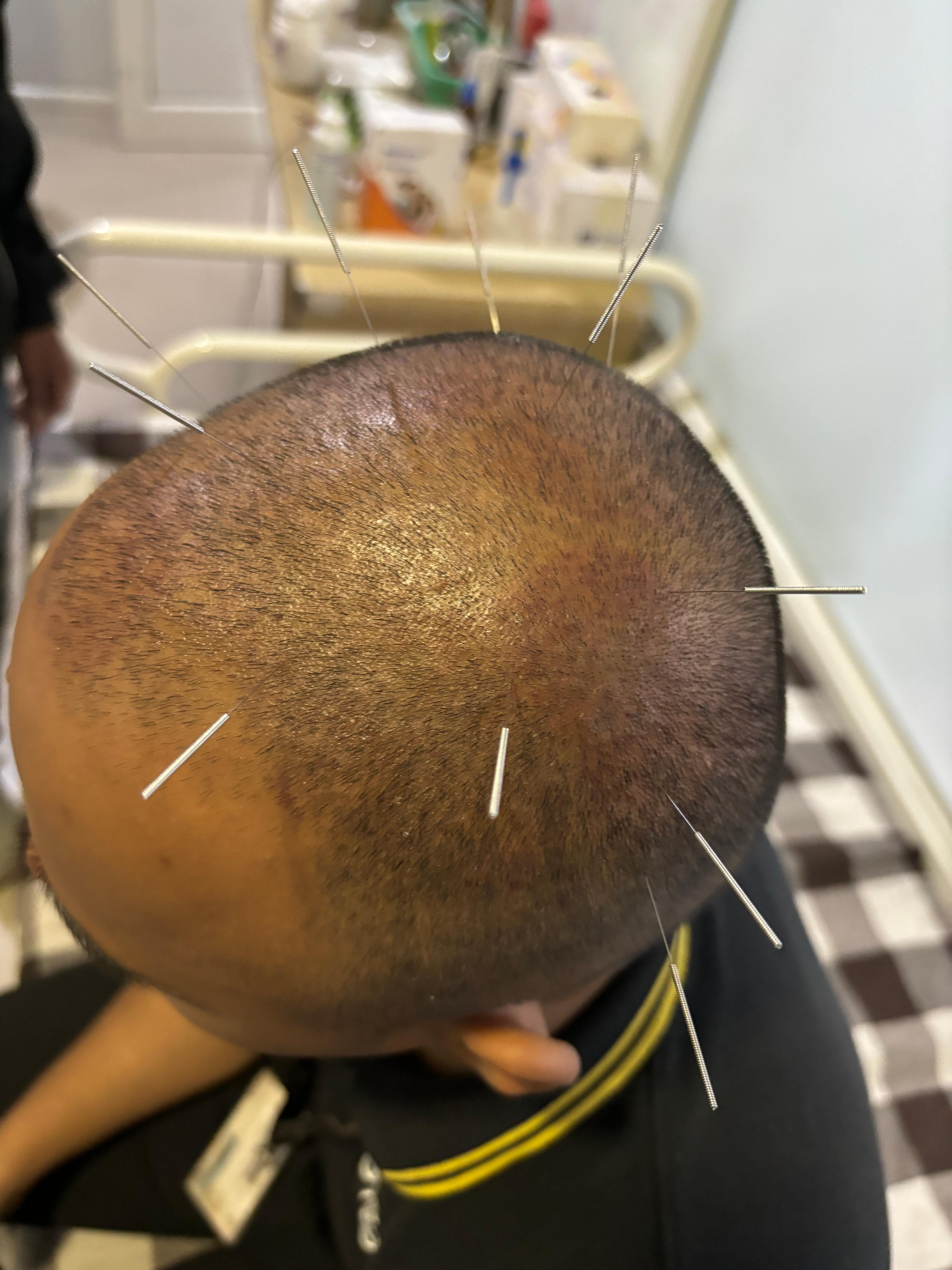 Interior view photo of Dr Raj Taskar Acupuncture & Cupping Clinic - Photo 3 at surat 422001
