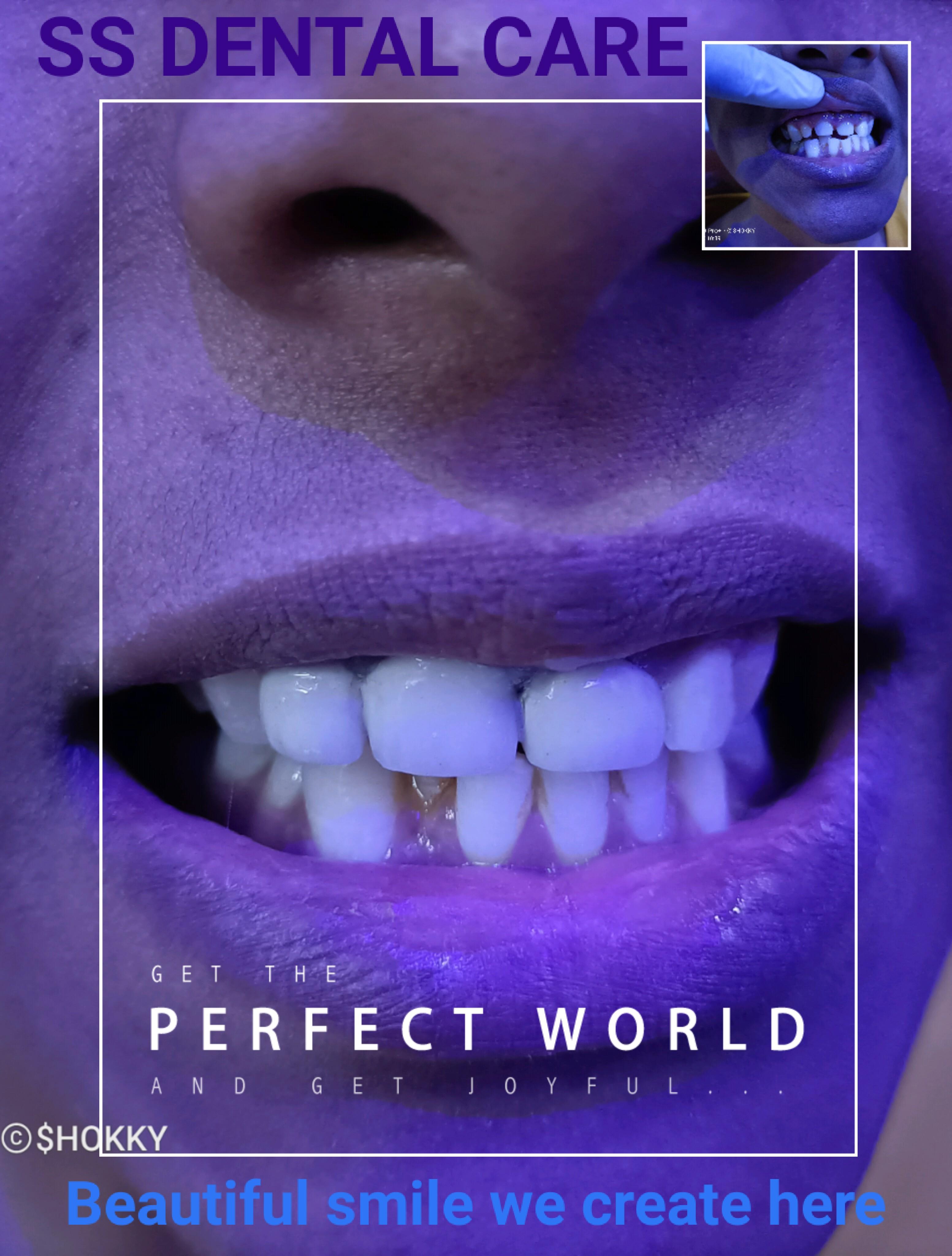 Patient consultation experience photo of SS DENTAL CARE - Photo 2 at na 814133