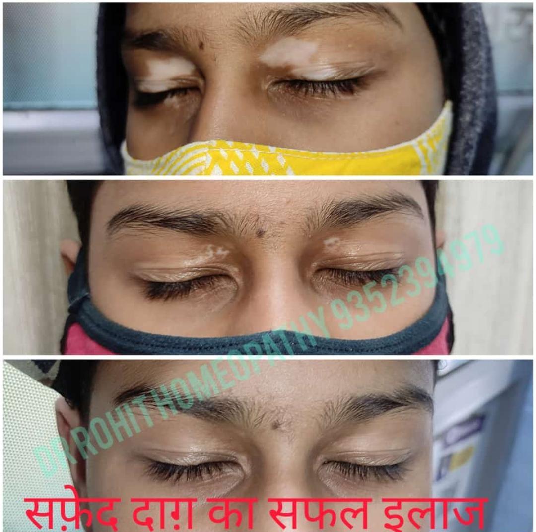 Patient consultation experience photo of Dr Rohit's Homeopathy - Photo 2 at bharatpur 321001