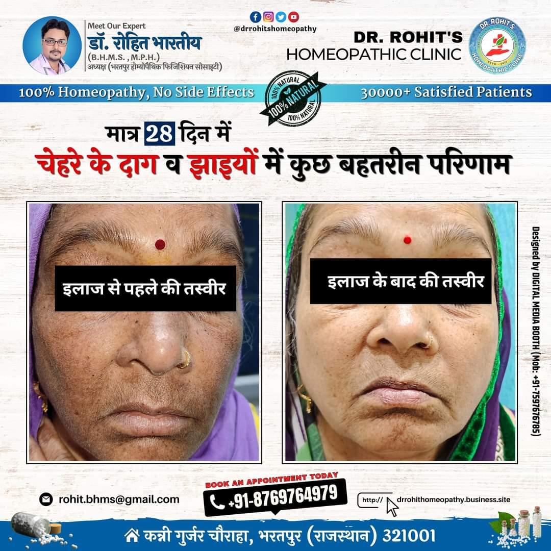 Patient consultation experience photo of Dr Rohit's Homeopathy - Photo 3 at bharatpur 321001
