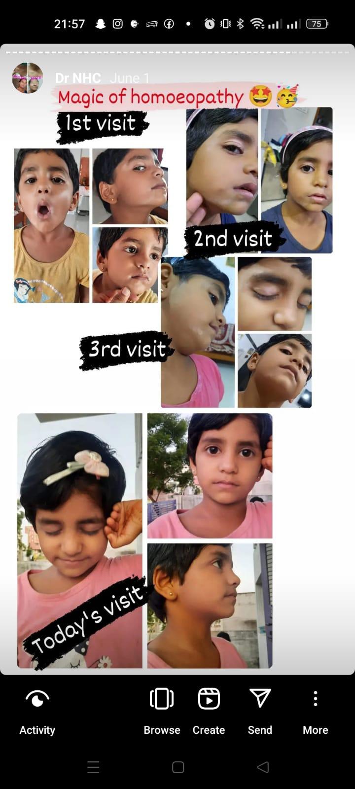 Patient consultation experience photo of Dr Nikita's homoeopaathic clinic - Photo 2 at shahada 425409