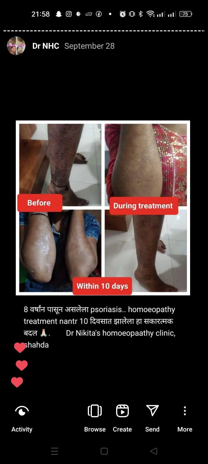 Patient consultation experience photo of Dr Nikita's homoeopaathic clinic - Photo 3 at shahada 425409