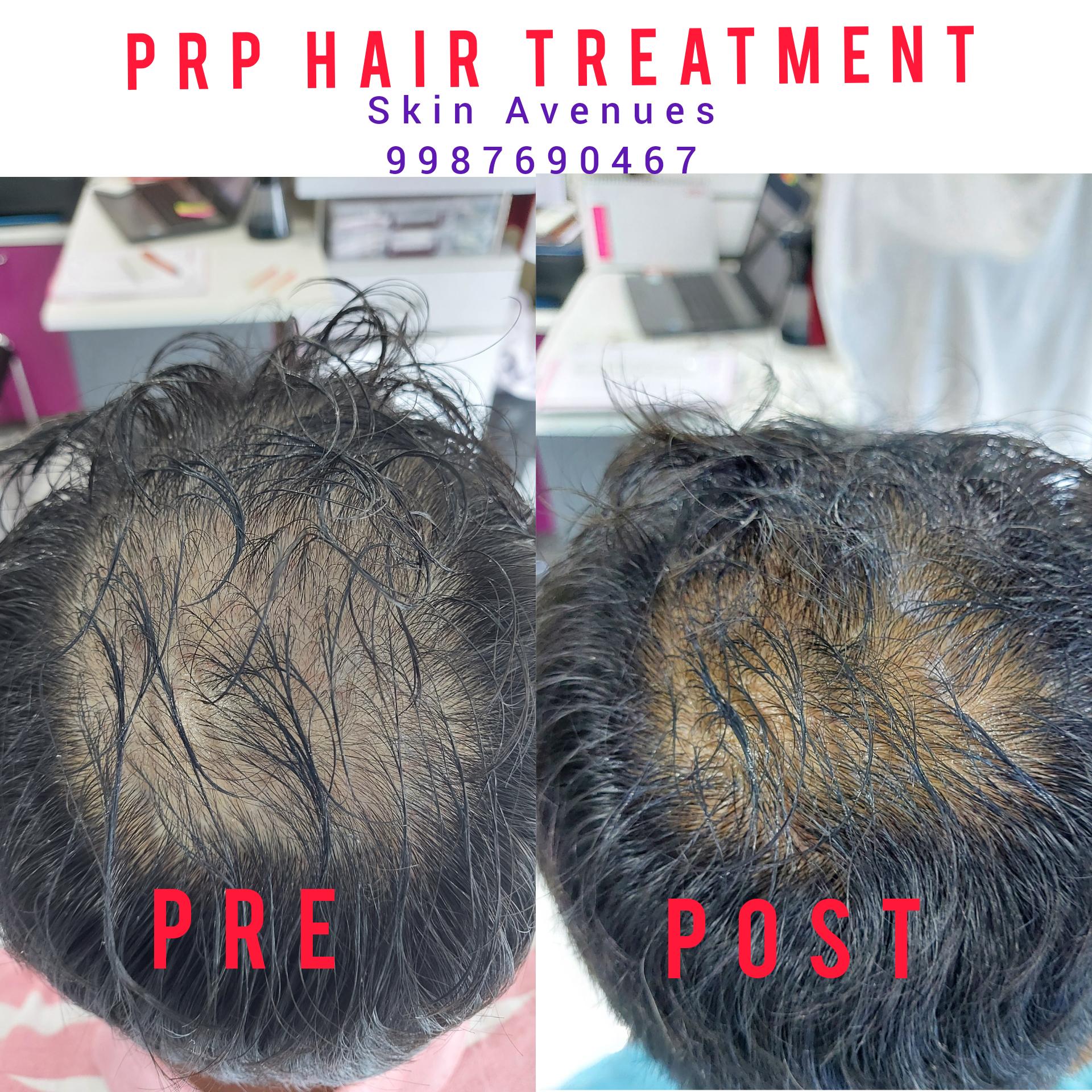 Clinic signage photo of Skin Avenues Clinic - Photo 1 at pune 411014