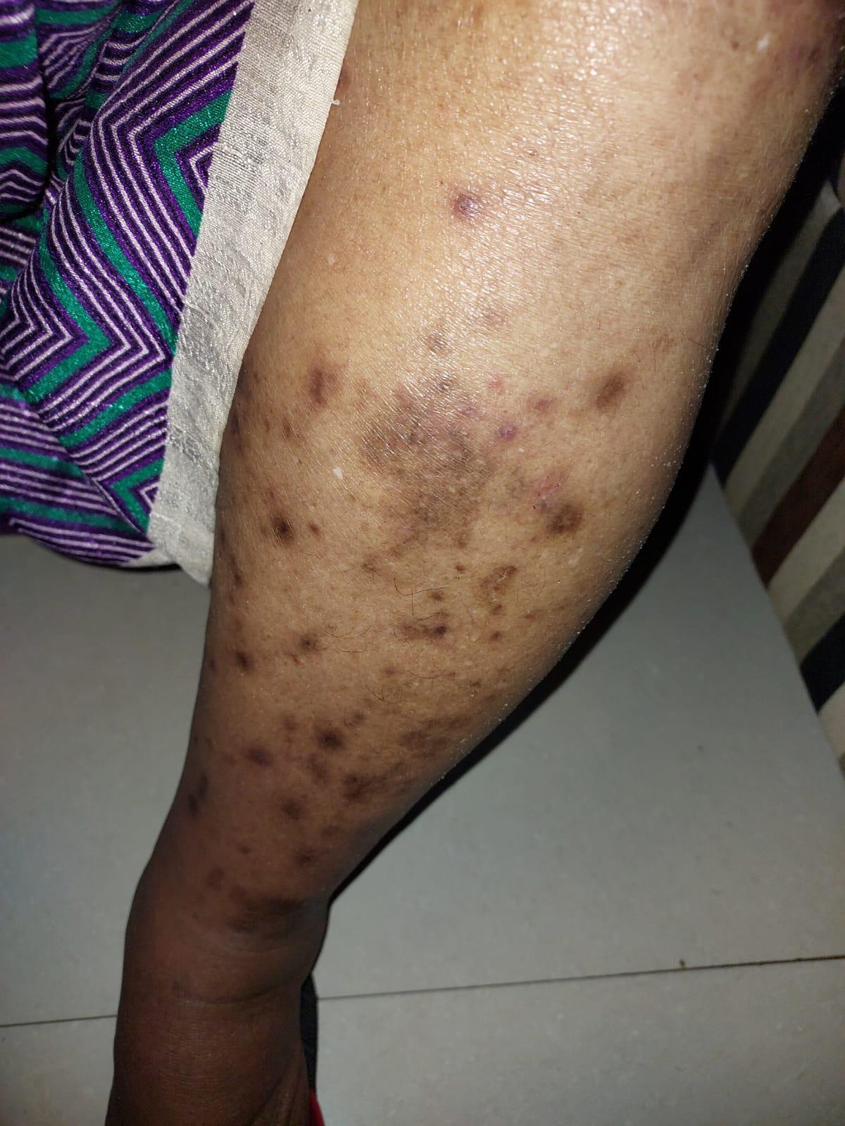 Patient consultation experience photo of Sankalp Homoeo Chikitsalaya & Research Centre - Photo 1 at bhopal 462042