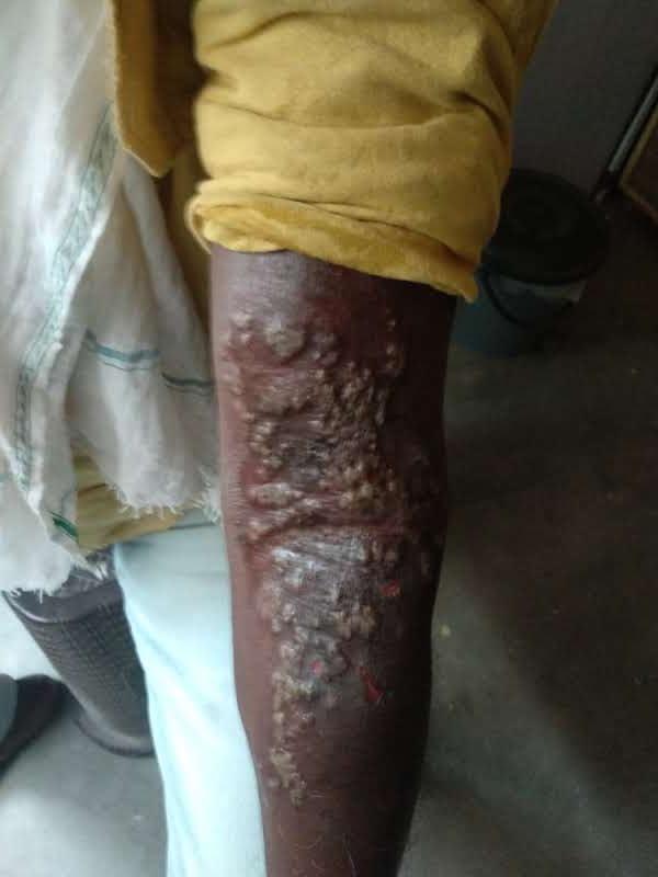 Patient consultation experience photo of Sankalp Homoeo Chikitsalaya & Research Centre - Photo 3 at bhopal 462042