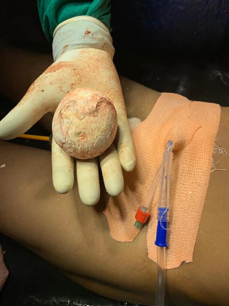 Exterior view photo of Dr Surya Nandan Singh Surgical Care Hospital - Photo 2 at Jamui 811307